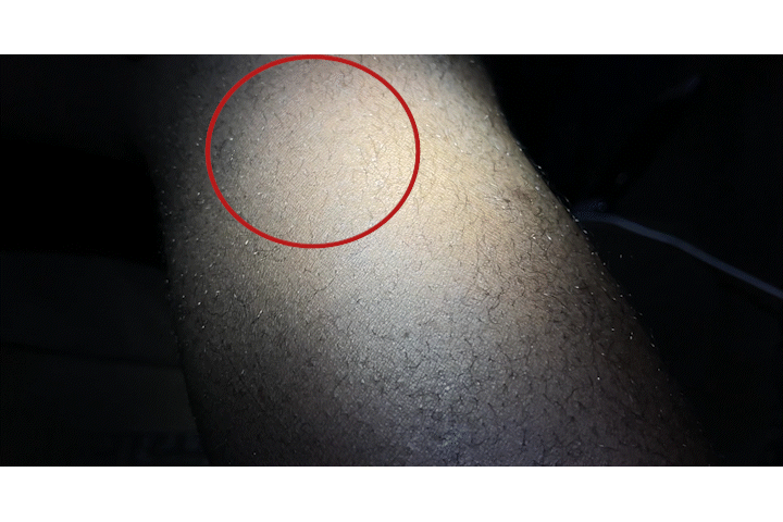 13A_mosquito landing GIF