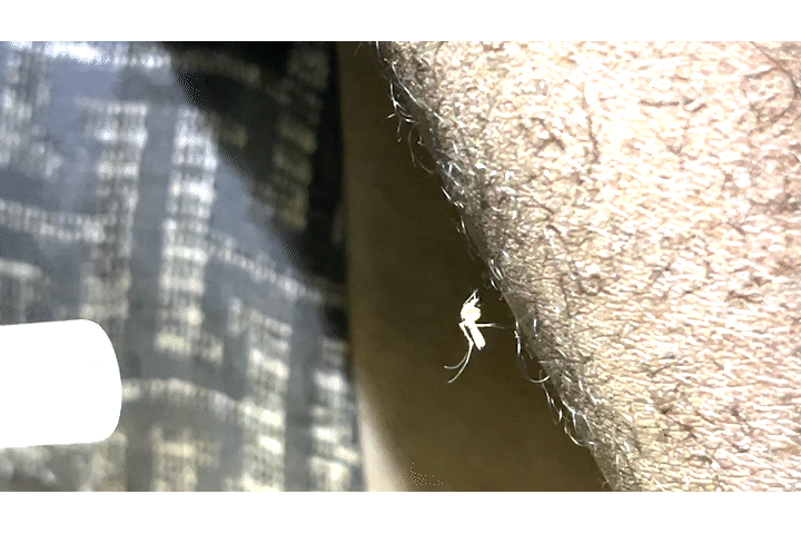 13B_Mosquito aspiration GIF