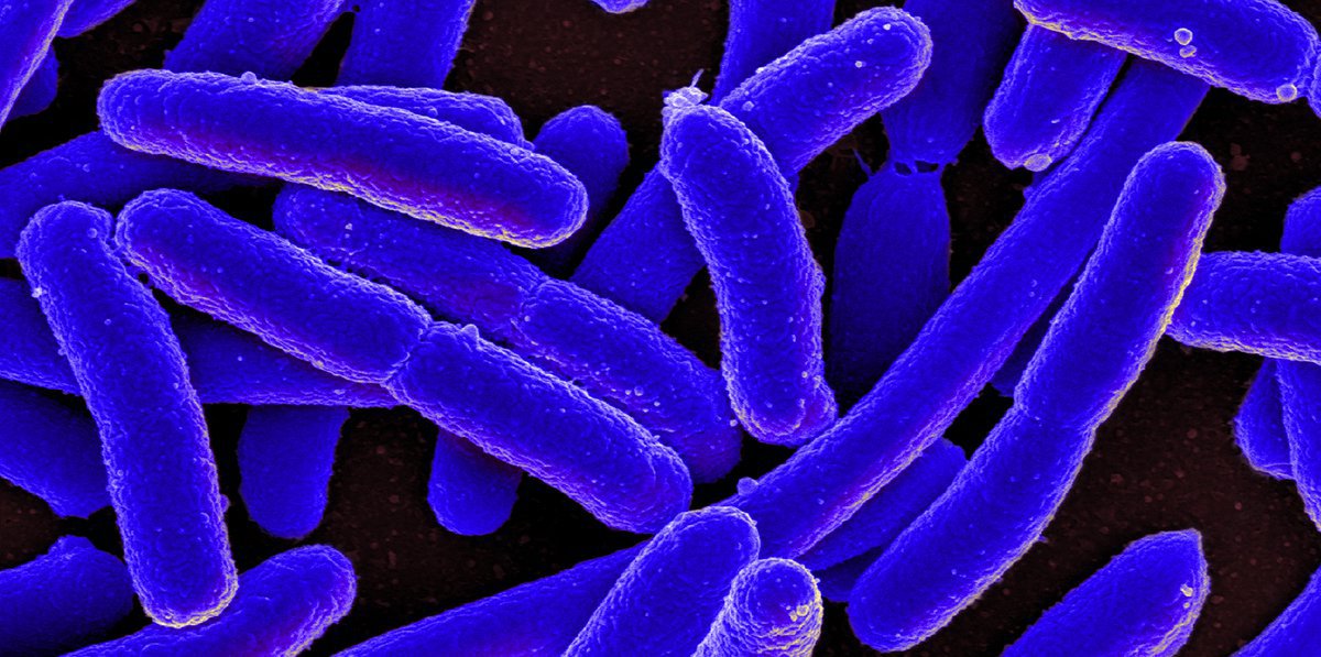e-coli-flickr-credit-niaid.max-1440x960.jpg