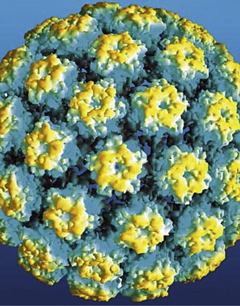 An atomic model of human papillomavirus L1 vaccine-like particles joined together to form a sphere. Image: Elsevier Ltd.